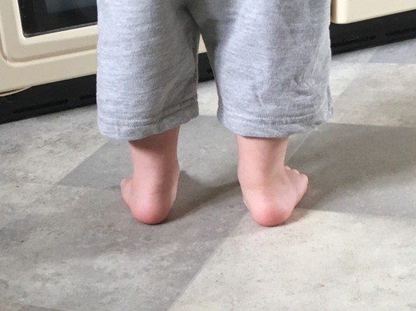 Albie feet 1