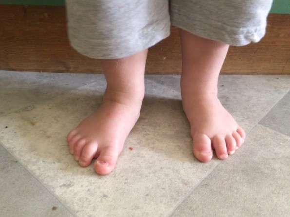 Albie feet 2