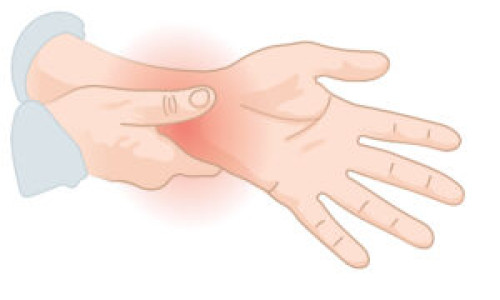 Carpal Tunnel