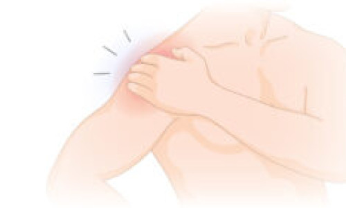 frozenshoulder