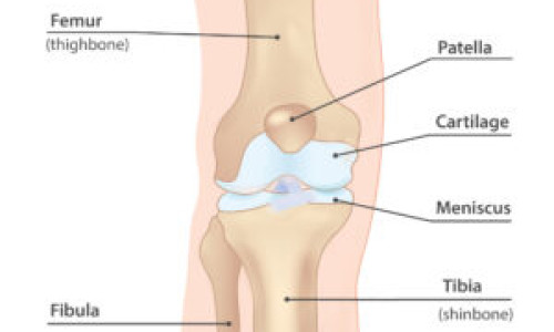 Knee Meniscal Injury