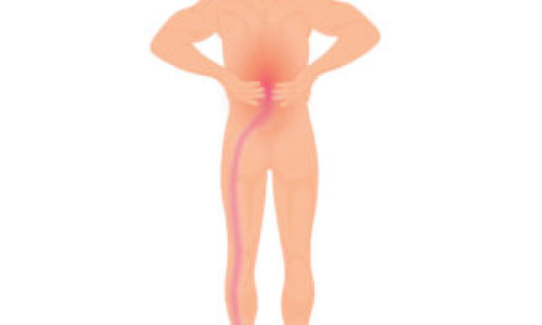 Lumbar Spinal Stenosis