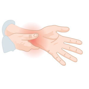 Carpal Tunnel