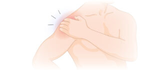 frozenshoulder