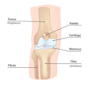 Knee Meniscal Injury