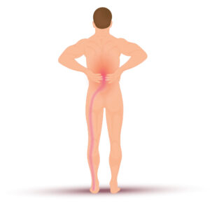 Lumbar Spinal Stenosis image